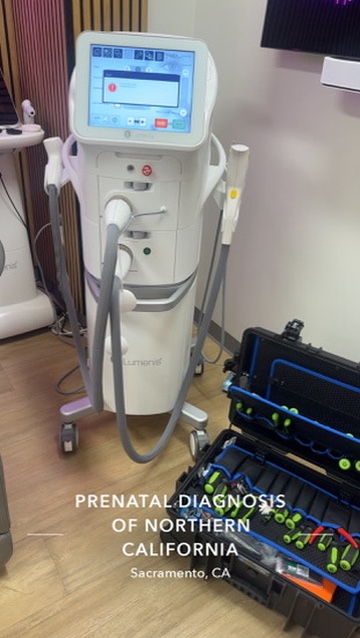 Lumenis laser platform showing handpieces, cables, and internal components
